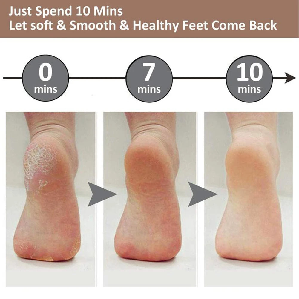 SilkStep™ Callus Remover