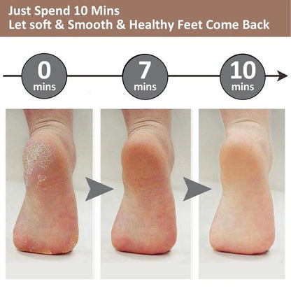 SilkStep™ Callus Remover