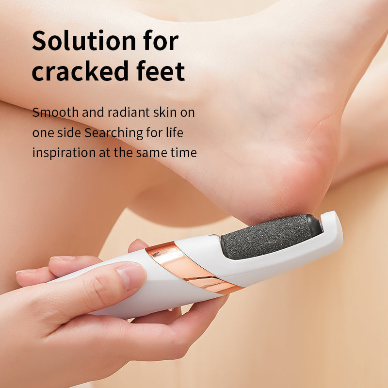 SilkStep™ Callus Remover